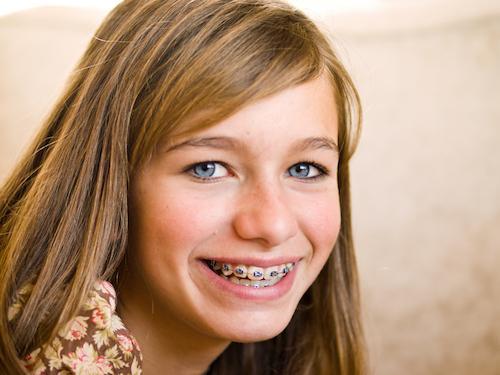 Braces in Santa Monica | Smiling Teen